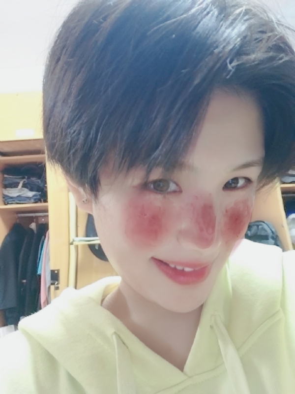 ⑤41的第一张照片--湖北残疾人相亲网